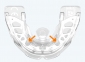 Міобрейс (Myobrace) AА2 Stage 2 Medium (елайнер) 4