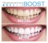 Opalescence Boost PF 40% (Опалесценс буст) 3