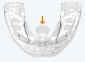 Міобрейс (Myobrace) AА2 Stage 2 Medium (елайнер) 6