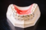 Проволока ортодонтическая 1.2 6