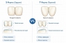 Гарнітур зубів Kaili T8/L8/34M А3 3