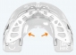 Міобрейс (Myobrace) AА2 Stage 2 Medium (елайнер) 5